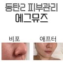 동탄 피부관리 세멘시트 사용하는 에그뮤즈 다녀왔어요
