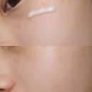 크로샷 | 닥터지 바쿠치올 포어젯 세럼, 마이크로샷패치 - 레티놀 대체템
