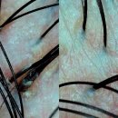 씨유명지국제호반점 | 부산 강서구 국제신도시, 두피디톡스로 탈모방지 올가드림뷰티 명지점