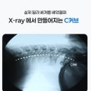 [네이버 넾다세일] 거북목 베개 추천, 정형외과 전문의가 만든 밀라 경추베개 솔직 후기