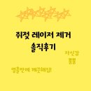 쥐젖 레이저 제거 솔직후기 (후기 사진 없음) - 이젠 자신감 뿜뿜 😄
