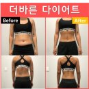 위례별한의원 | 마운자로 복용으로 위장장애, 췌장염, 담낭염 걱정된다면 안전한 한약 다이어트로 [위례 다이어트 한의원]