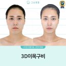 동창원농협(본점) | 창원 신부관리 비대칭 윤곽관리 고운빛깔 에스테틱 10회차 후기