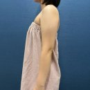 탑메디의원 | 강남역온다리프팅 잘하는곳 팔뚝살 통증 효과 후기