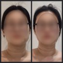 분당판교-D-5 | [분당/판교] 판교 에스테틱 판교 예신관리 디케이스파 목어깨관리 후기