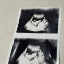 토종한의원 | 대추밭백한의원 후기: 예약, 임신 실패, 체질개선, 난임 그리고 흑염소