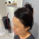 진헤어라인 이미지