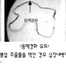 뽕이랑 귀농이랑 Daum카페