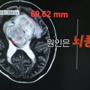 서울아산신경외과 이미지