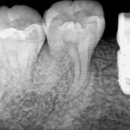 성모치과기공소 이미지