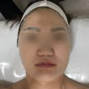 진접에스테틱 청춘관리 커스터마이징 스킨솔루션 후기