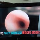 팔팔 백세의 시작 구강 건강,구강건조증 이미지