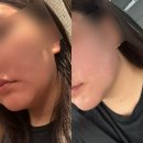 빛나리움에스테틱 | 서산피부관리 빛나리움에스테틱 근막관리 후기