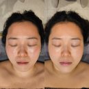 프로젝트핏 | 피부 컨디션 회복 프로젝트 | 결앤핏에서 받은 슈퍼젝션후기