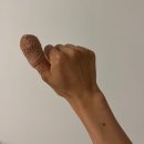 바른본병원 | 채칼사고 손가락 베임, 본바른병원 수술후기