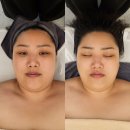 소담뷰티 | 상무지구윤곽관리 소담뷰티랩 후기 | 상무지구전신관리 광주웨딩관리로 받은 수기 윤곽관리