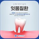 항동서울치과의원 네이버블로그