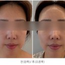 수얀스킨케어