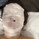 광주상무점 디바스킨 | 광주 신부관리 전문 디바스킨 광주상무점 에르모듀 콜드 플라즈마 후기