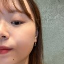 헤이사랑치과의원 | [군자 헤이사랑치과] 매복 사랑니(오른쪽 위) 발치 후기
