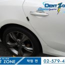 덴트존 이미지