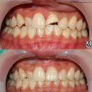 더디자인치과기공소 이미지