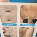 퀸도테라 - 28196 | 퀸도테라