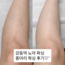 샬롬교회 | 강동역 왁싱 노아왁싱 | 여름맞이 깔끔한 종아리 왁싱 후기