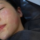 조앤의료기기 | 서현역 피부과 텐써마 300샷 후기｜탄력 &amp; 팔자 고민 리프팅 관리 후기