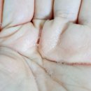 소백슈퍼 | 모공냉각 워터에센스로 수부지 모공·각질·피부결 변화. 피네수 소백솔잎 워터에센스