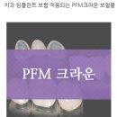 임플란트 보험적용되는 PFM크라운 치료 -대구 준치과- 이미지