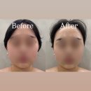 친구 따라 방문한 부산교대에스테틱 ‘이루다움 에스테틱 부산교대점’ 솔직후기