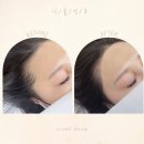 토탈헤어라인 - 평택시 | 토탈헤어라인