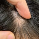 헤어온의원 이미지