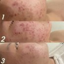 현메디케어 이미지