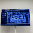 최원혁사랑니치과의원 이미지