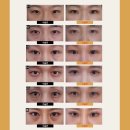 이노케이스 이미지