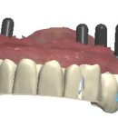 용현치과기공소 이미지