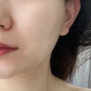괴정동 회화나무 소공원 | 괴정동피부관리 추천 바른결에스테틱 속건조장벽케어 후기