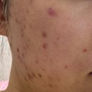 미웰빙피부샵 | 부개동 피부관리 미피부샵 내돈내산 후기