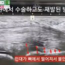 케이스대학