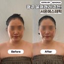 호동로 | 광주 북구 섬세한 윤곽관리 추천 서온에스테틱 온결테라피 후기