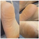 대구 북구 대현로19길 53 | 대구발각질 침산동 패디플리닝 안나뷰티 굳은살관리