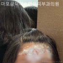 에스앤유피부과의원 네이버블로그