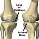 튼튼병원 이미지