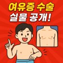 트루맨남성의원 | 💪"남자 여유증 수술 직접 해봤습니다. 진짜 인생 바뀌어요 (실제 후기+비포애프터 포함)"