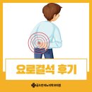 예술로3L | 요로결석 후기 검사 통증 증상 예방법