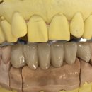 수치과기공소 이미지