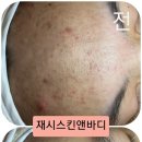제노필 이미지