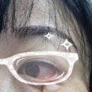 보라안과의원 이미지